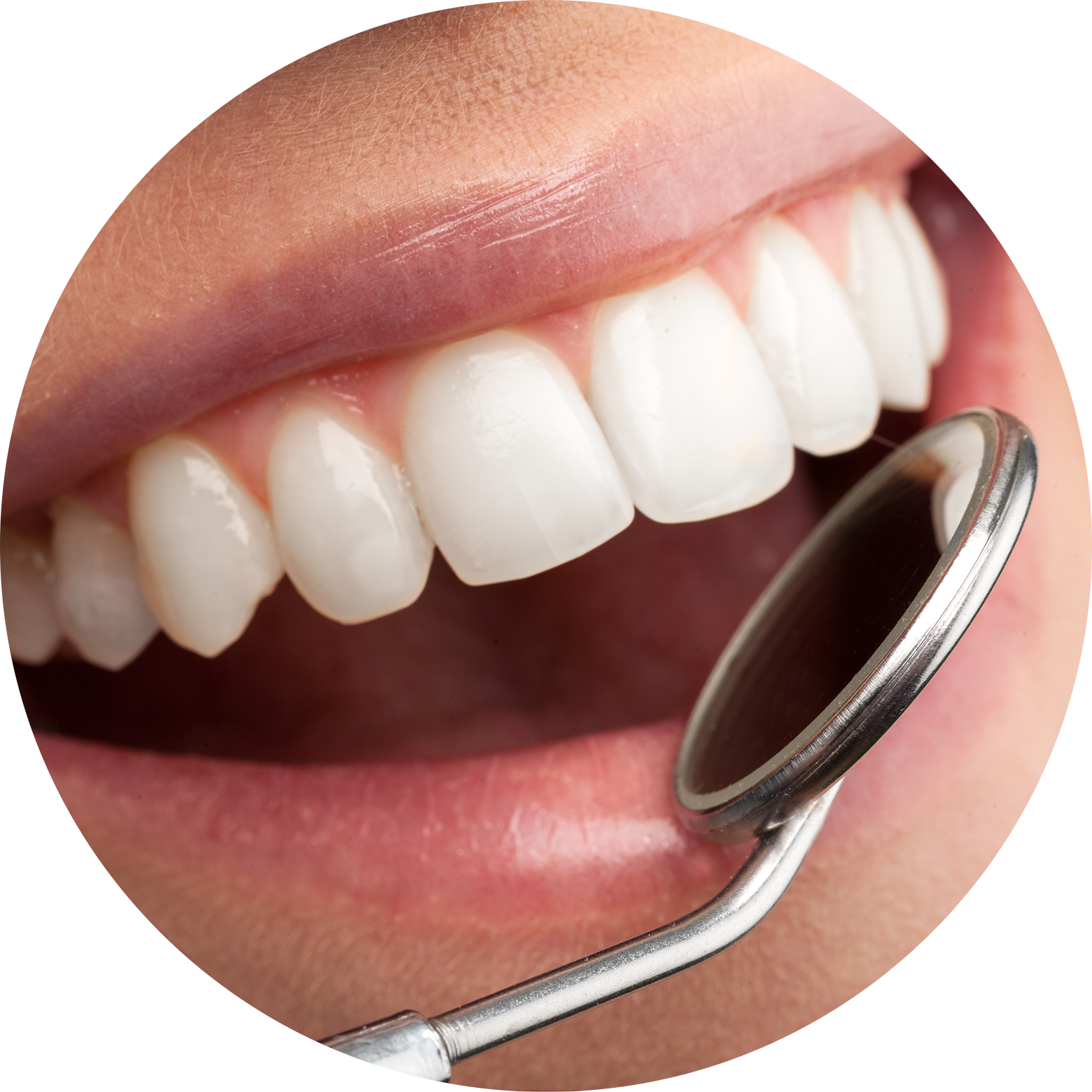 Teeth Cleanings